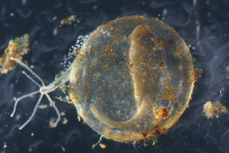 unidentified aquatic egg, hydra, and cluster of vorticella
