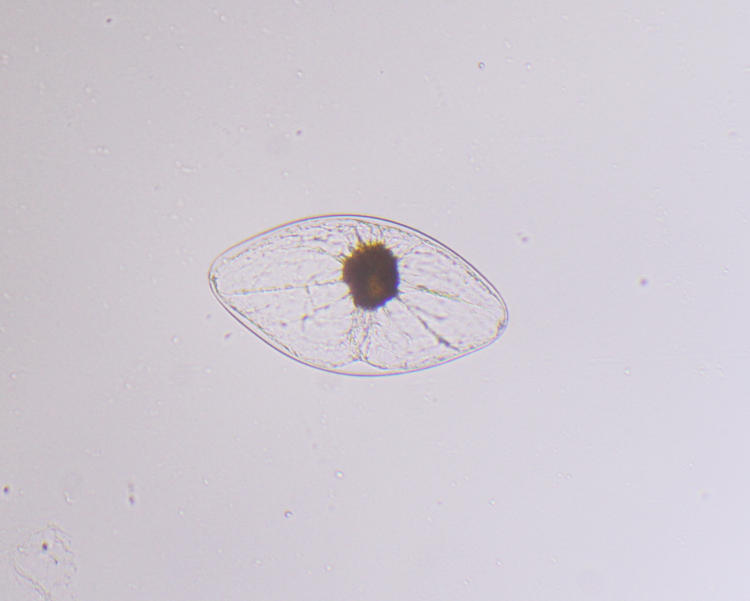 bioluminescent dinoflagellate pyrocystis fusiformis under microscope