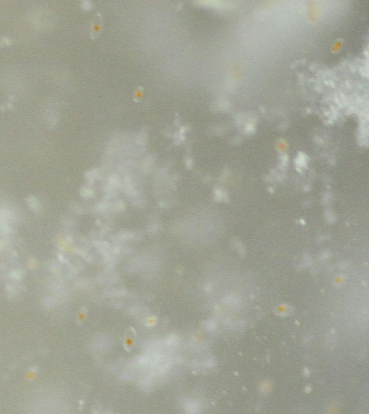 high-resolution inset of frame showing dinoflagellates against sides