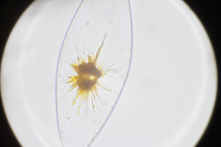 bioluminescent dinoflagellate pyrocystis fusiformis under microscope
