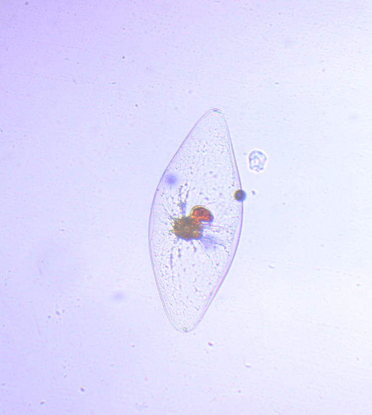 bioluminescent dinoflagellate Pyrocystis fusiformis under microscope