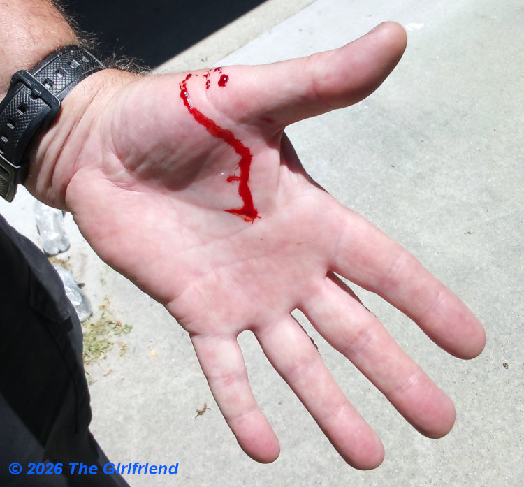 authors hand bleeding more than a little from bite of eastern racer Coluber constrictor; photo by The Girlfirend